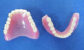 レジン床義歯の写真