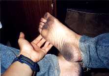 写真１：足の裏が真っ黒！！